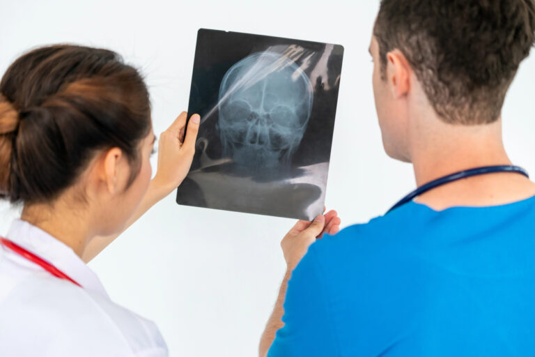Baton Rouge Traumatic Brain Injury Lawyer - Rozas Injury Law